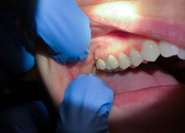 Best Orthodontic Emergency Dentist in North Auburn, CA