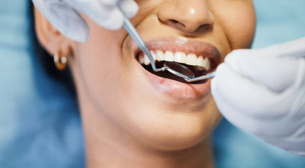 Best Emergency Dentist for Special Needs Patients in North Auburn, CA
