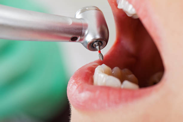 Best Emergency Cosmetic Dentistry in North Auburn, CA